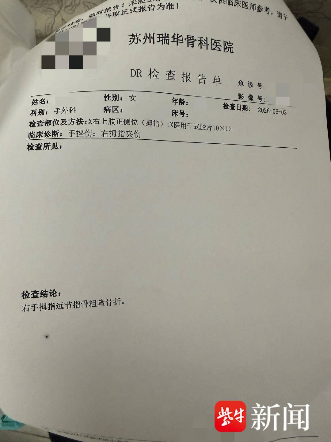 女子被小米SU7电吸门夹手指致骨折,小米回应:电吸门确无防夹功能,存在夹伤风险